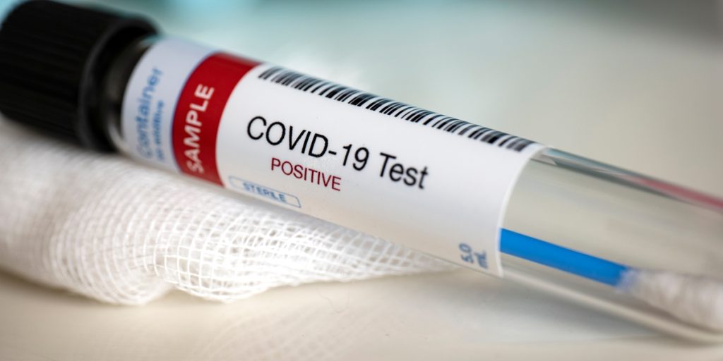 Covid PCR test - anna pharmacy