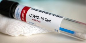 Covid PCR test - anna pharmacy