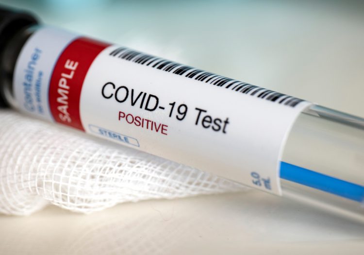 Covid PCR test - anna pharmacy