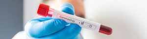 Coronavirus Test - Anna Pharmacy