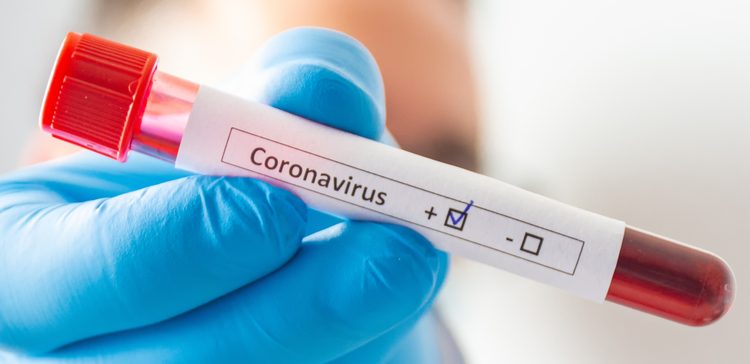 Coronavirus Test - Anna Pharmacy