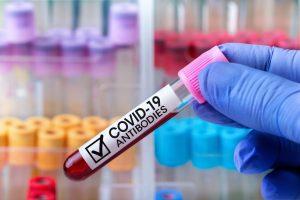 Covid-19 Antibody test