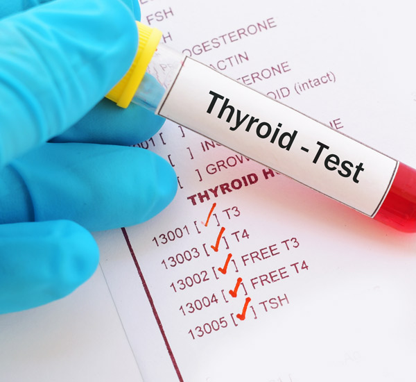 Full Thyroid Blood Test