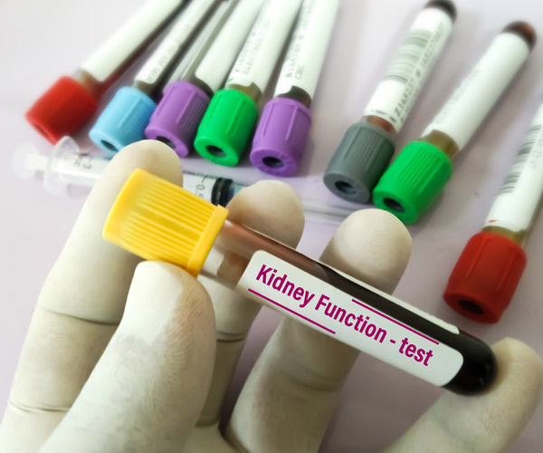 Kidney Function Test