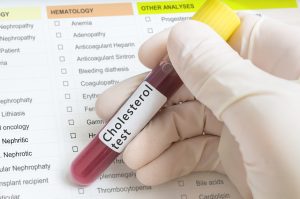 Cholesterol Blood Test