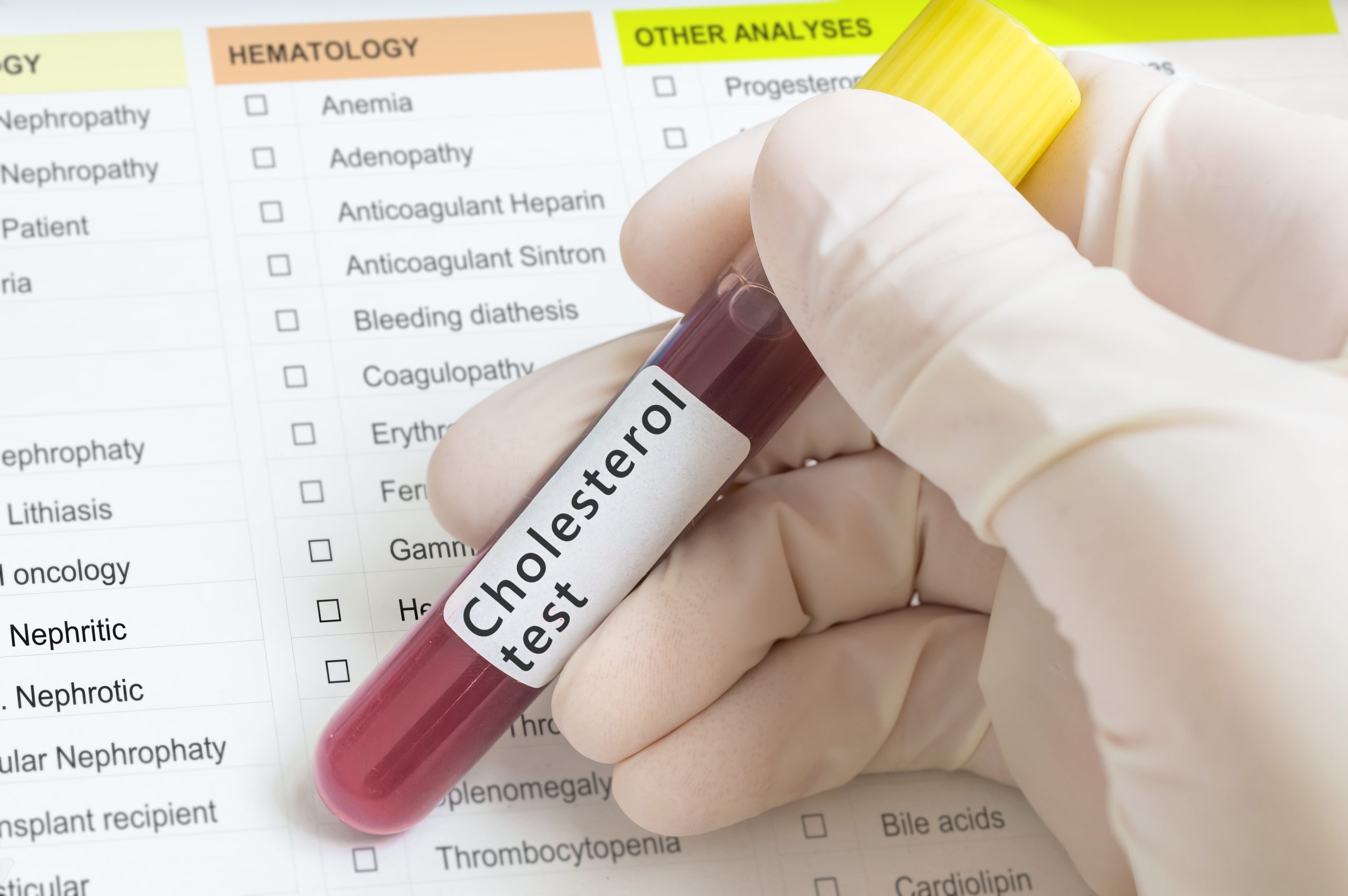Cholesterol Blood Test