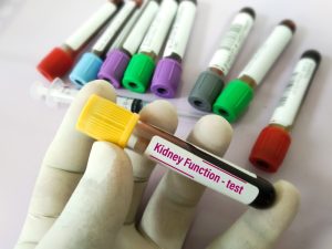 kidney function tests