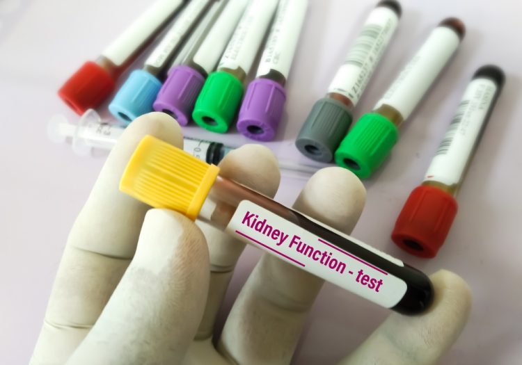 kidney function tests