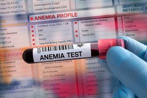 iron anaemia blood test in Sutton