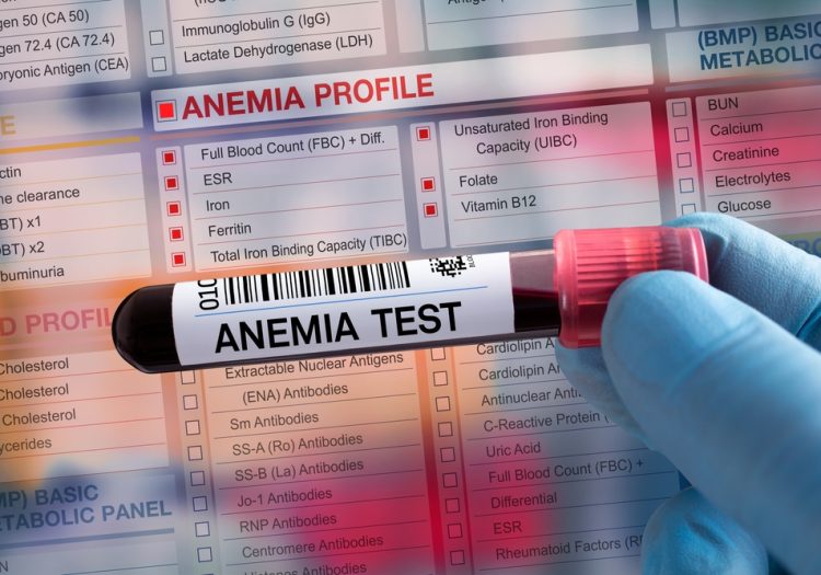 iron anaemia blood test in Sutton