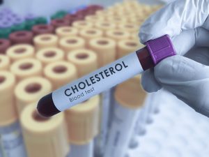 Cholesterol Blood Tests