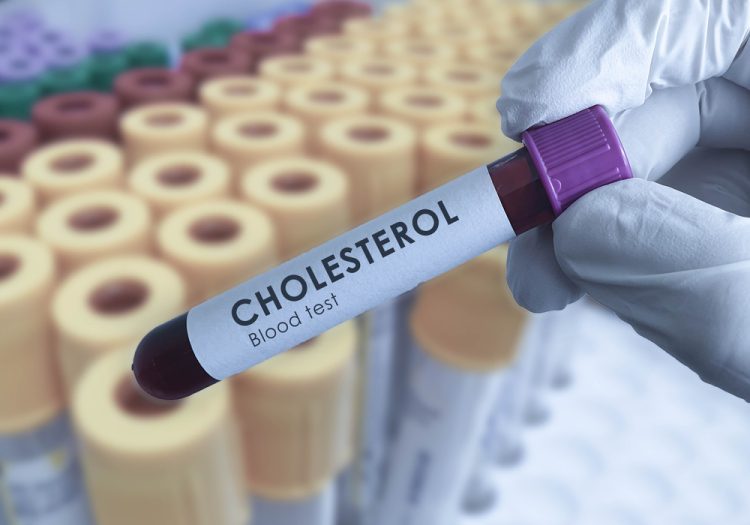 Cholesterol Blood Tests