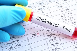 cholesterol blood test in Croydon