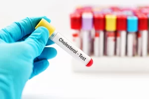 cholesterol tests in Wallington