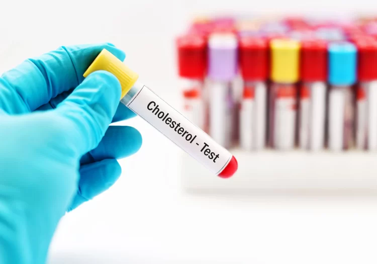 cholesterol tests in Wallington