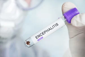 Tick-borne Encephalitis Vaccine