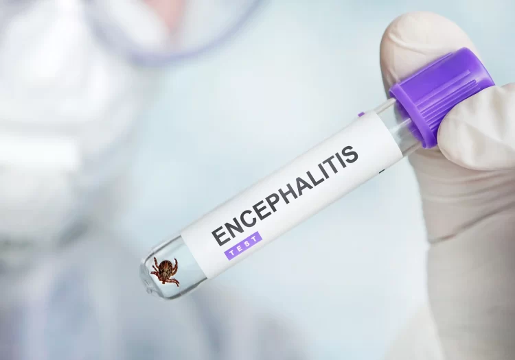 Tick-borne Encephalitis Vaccine