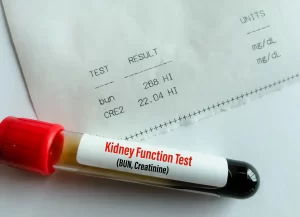 kidney function blood test in Sutton