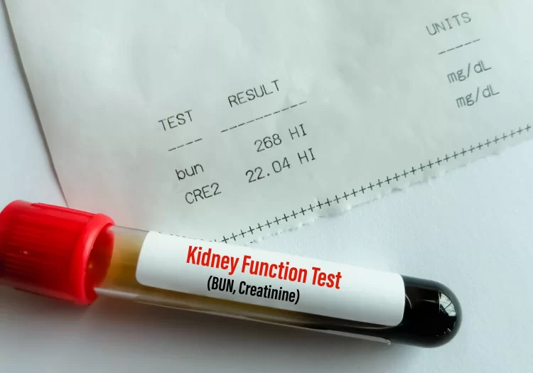 kidney function blood test in Sutton