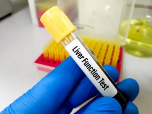 blood test for liver function