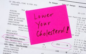 Can You Lower Cholesterol Without Medication? Anna Pharmacy's Expertise