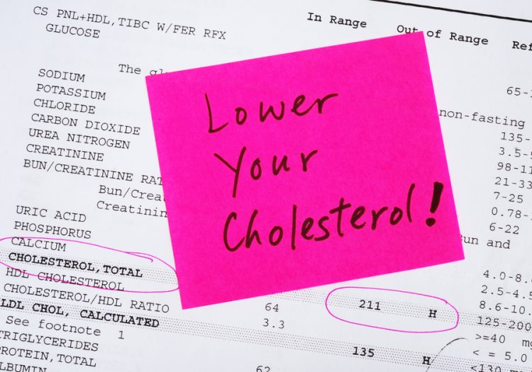 Can You Lower Cholesterol Without Medication? Anna Pharmacy's Expertise