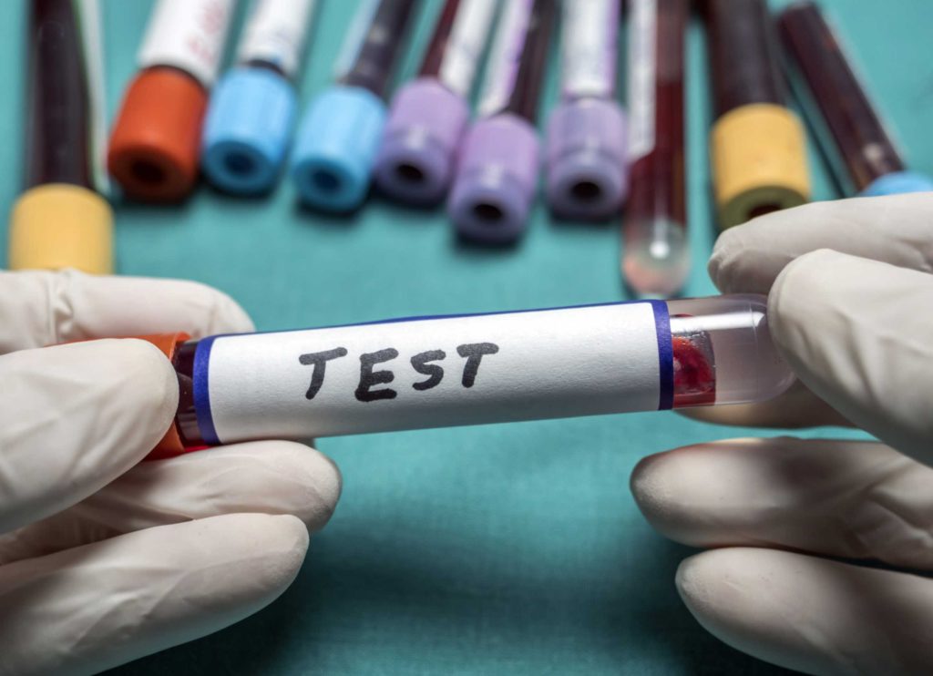 5 Crucial Liver Function Tests to Prioritise After Turning 30
