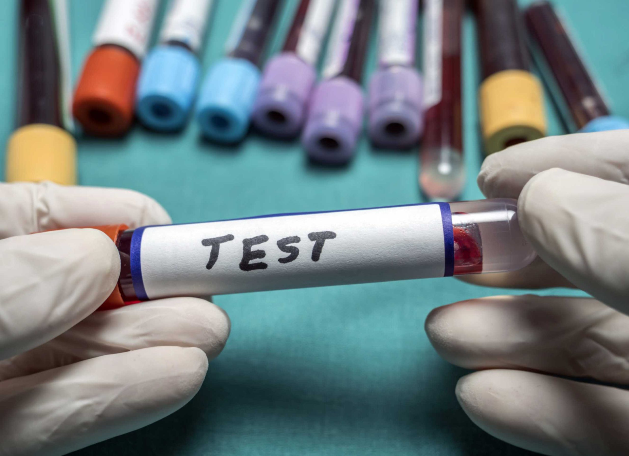 5 Crucial Liver Function Tests to Prioritise After Turning 30