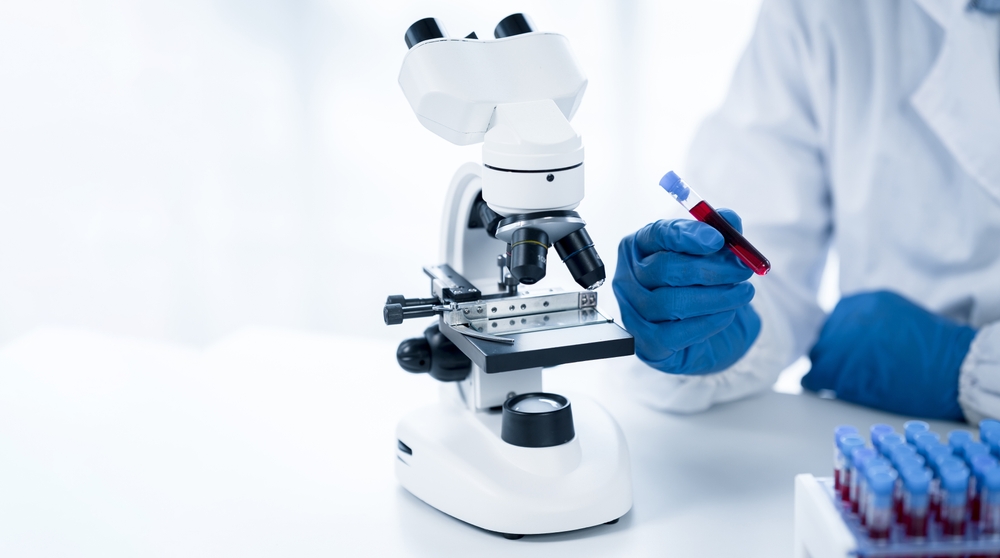 Why Should We Repeat Blood Tests Every 6 Months? Anna Pharmacy