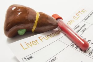Liver Function Tests - Miles