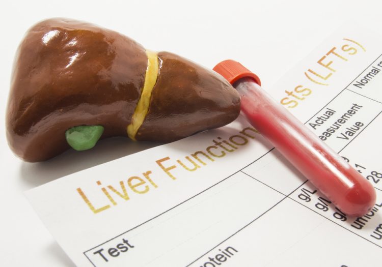 Liver Function Tests - Miles