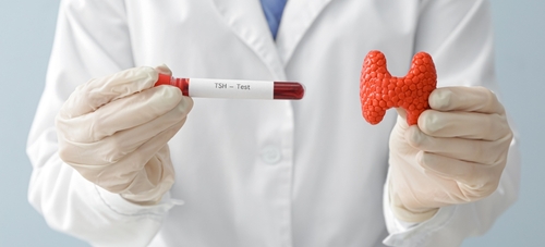 Thyroid blood test