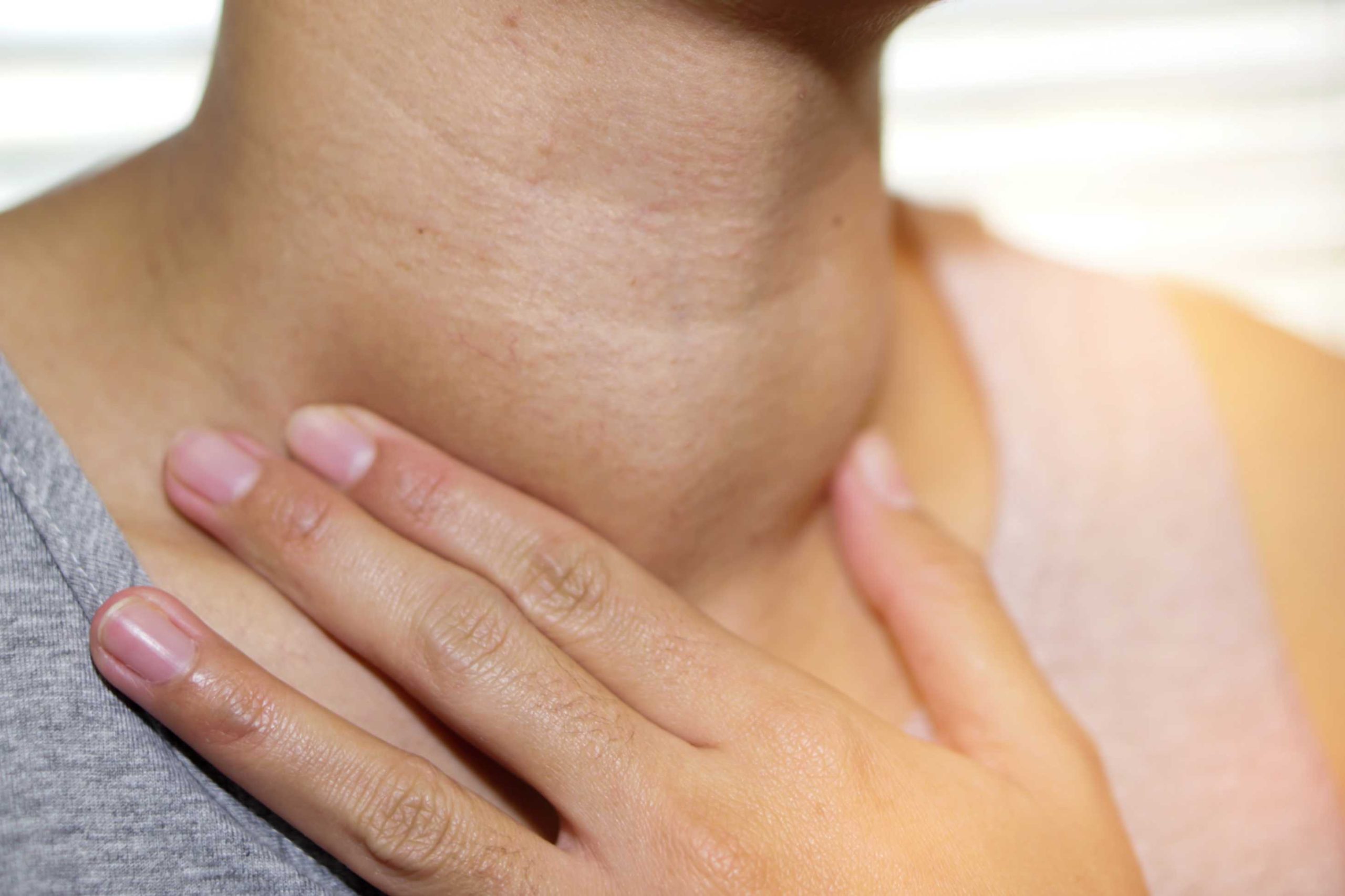 10 Early Signs of Thyroid Problems You Shouldn’t Ignore