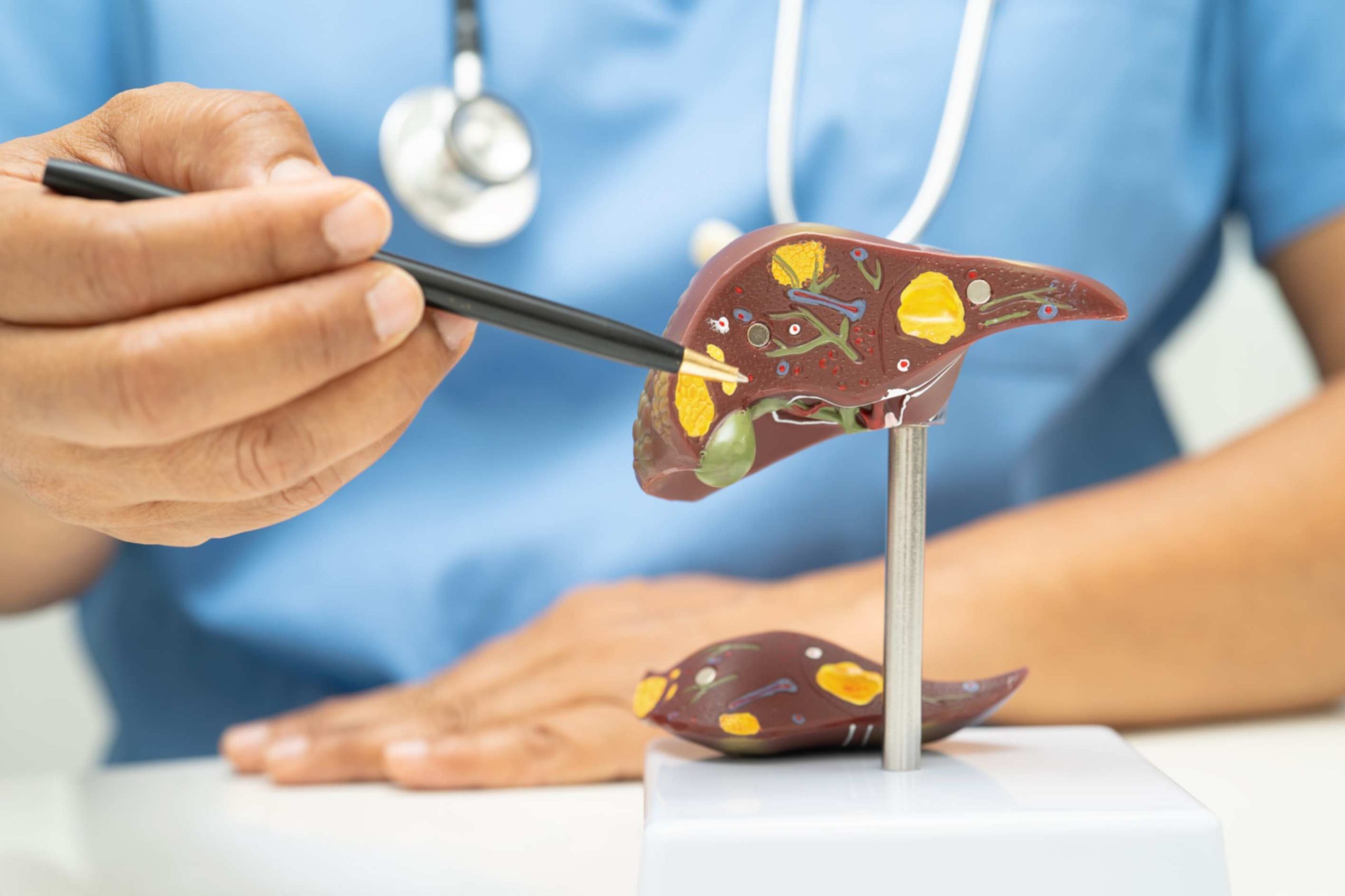 5 Lifestyle Habits that Can Lead to Liver Damaging