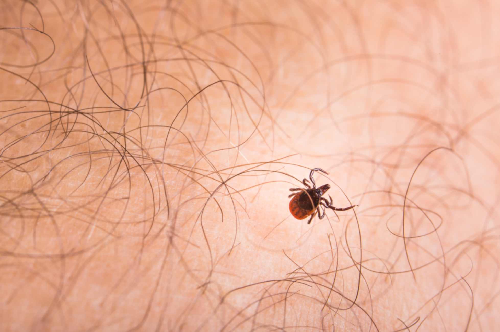 Tick-Borne Encephalitis: Why Spring and Summer Are High-Risk Seasons