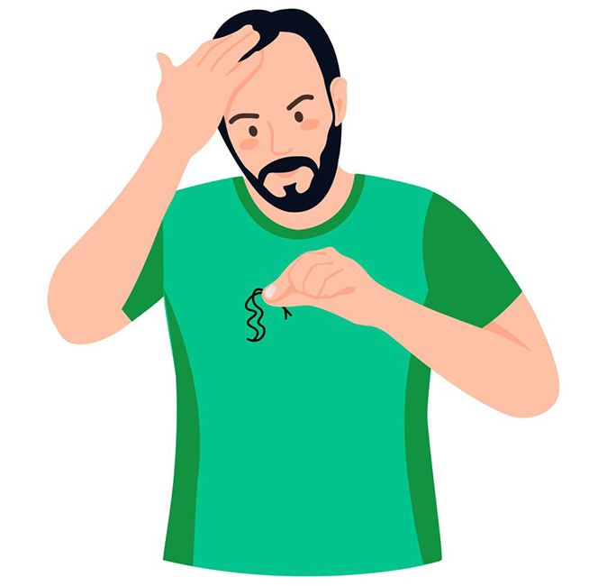 Mens-Hair-Loss-Treatment